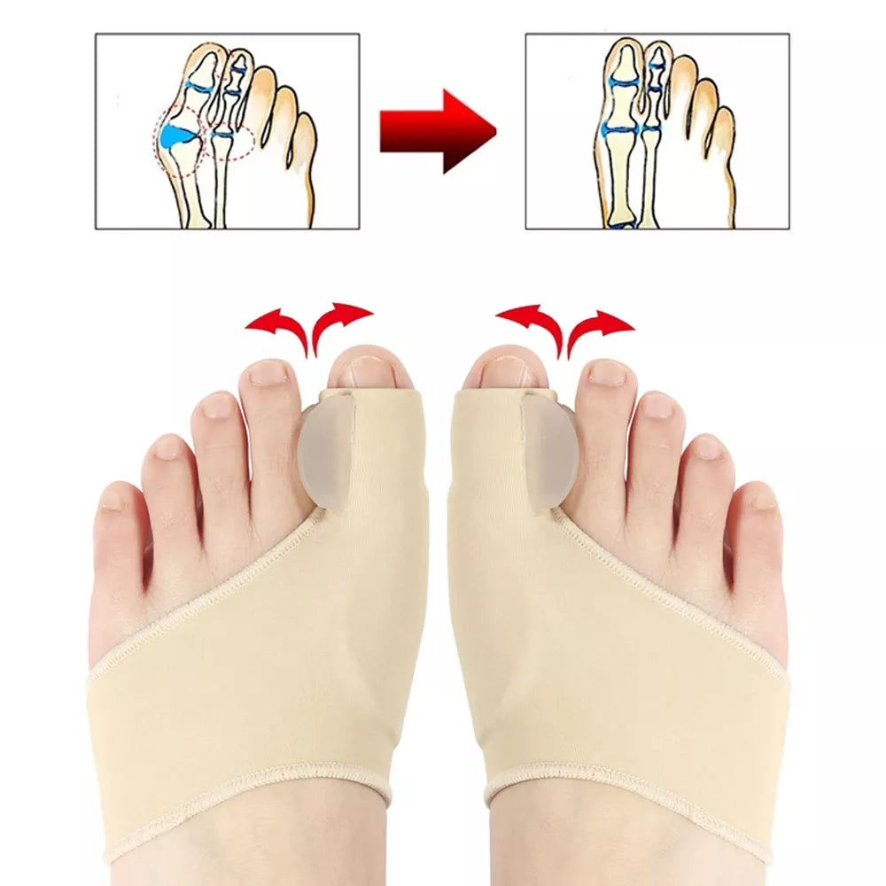 Bunion Corrector, Thumb Adjuster - VITOCLEI STORE