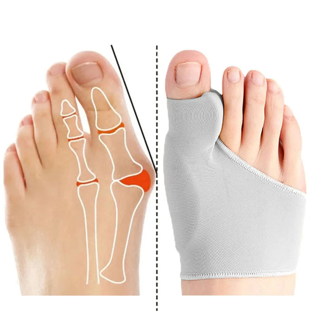 Bunion Corrector, Thumb Adjuster - VITOCLEI STORE